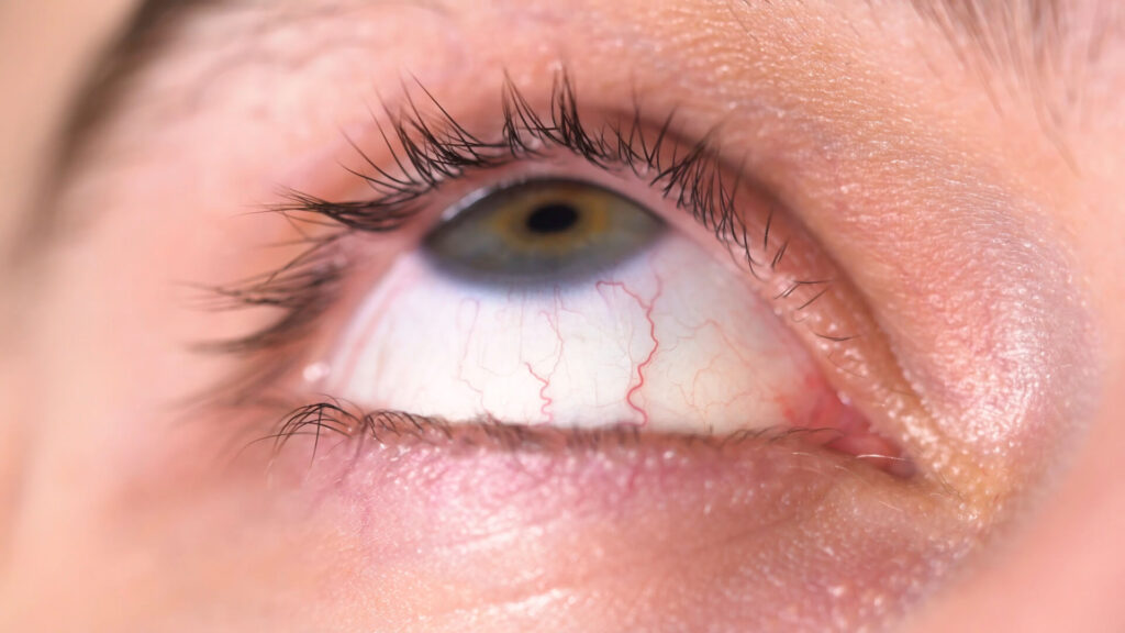 Сухость глаз и тревожные мысли могут быть связаны гораздо сильнее, чем кажется