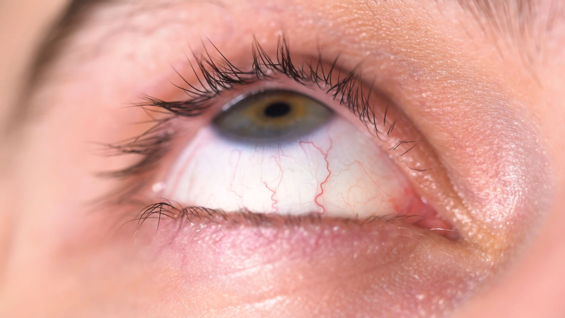 Сухость глаз и тревожные мысли могут быть связаны гораздо сильнее, чем кажется